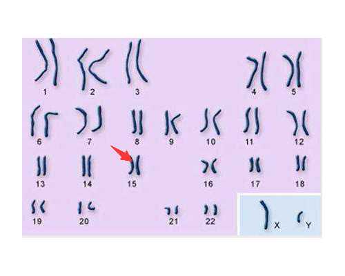 昆明正规代孕网,北京有做试管包成功的医院吗-试管三代为什么费卵子-子宫下垂