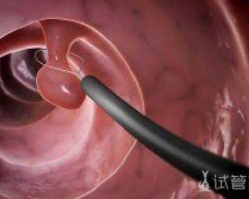 云南心悦代怀中心|成都助孕公司，成都试管婴儿双胞胎