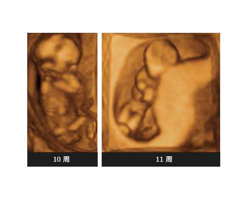 云南供卵试管去哪|温州人民医院做试管婴儿的手续费可以用医保报销吗？