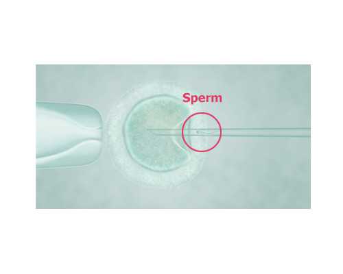 昆明辅助代孕网,昆明试管婴儿做需要多少钱，机构价格54486元