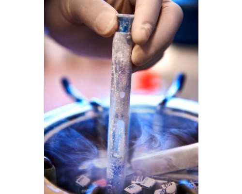 昆明代怀试管费用,梦美专题：去美国做试管服用辅酶Q10的意义-上海私立医院供