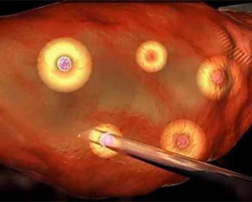 佩兰是什么药？具体的功效与作用是什么？