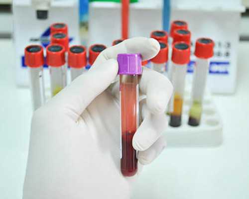 昆明代怀最新技术,青海省人民医院可以做供卵试管婴儿吗？成功率高吗？_高龄