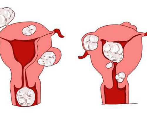 昆明怎样待代孕,山东试管能选性别吗？去山东做试管能不能生男孩？-上海供卵