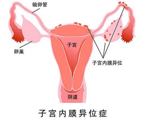 昆明今年有喜试管,试管移植当天到现在怀孕四周+5天，今早塞雪诺酮，管子上有