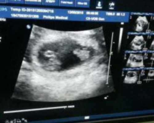 昆明正规医院有代孕吗,香港怀孕初期验血准吗_寄血过去可靠吗性别鉴定!-上海