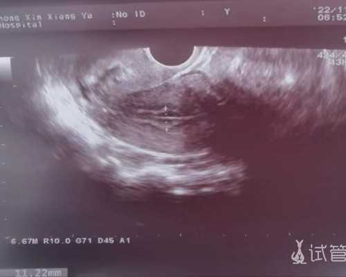 云南包性别代怀套餐|吉林试管婴儿补助政策最新消息，附2023
三代试管生男孩费