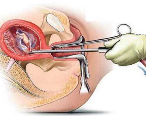 昆明哪里有人代孕,南昌医保能报销试管婴儿手术吗？南昌医保可不可以报试管