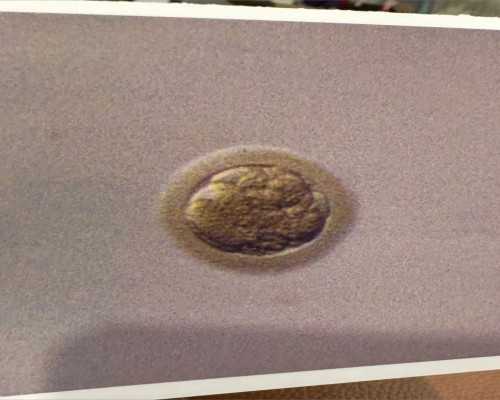 昆明同性供卵代生孩子,昆明供卵试管包生男孩医院排名？