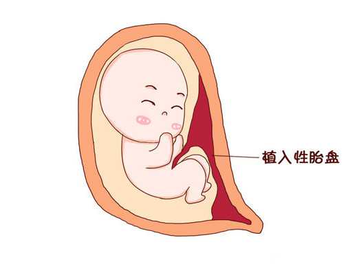 云南同性代生孩子|淮安市妇幼保健院能做三代试管吗？做试管多少钱？