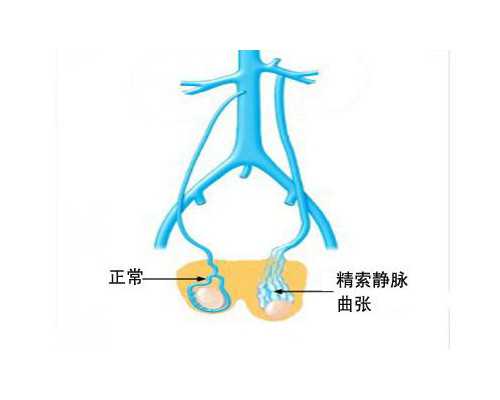 11个怀孕初期症状