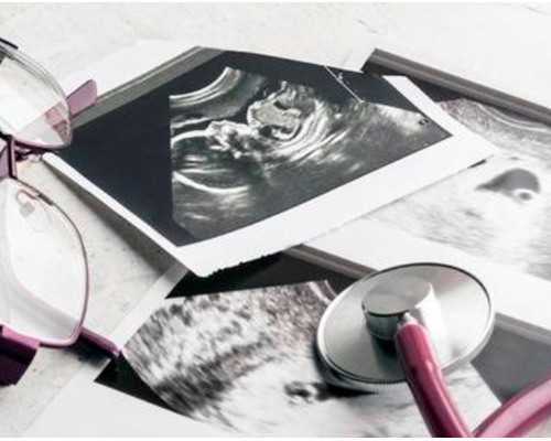 云南正规供卵医院|苏州做第三代试管婴儿流程解读！